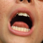 scream